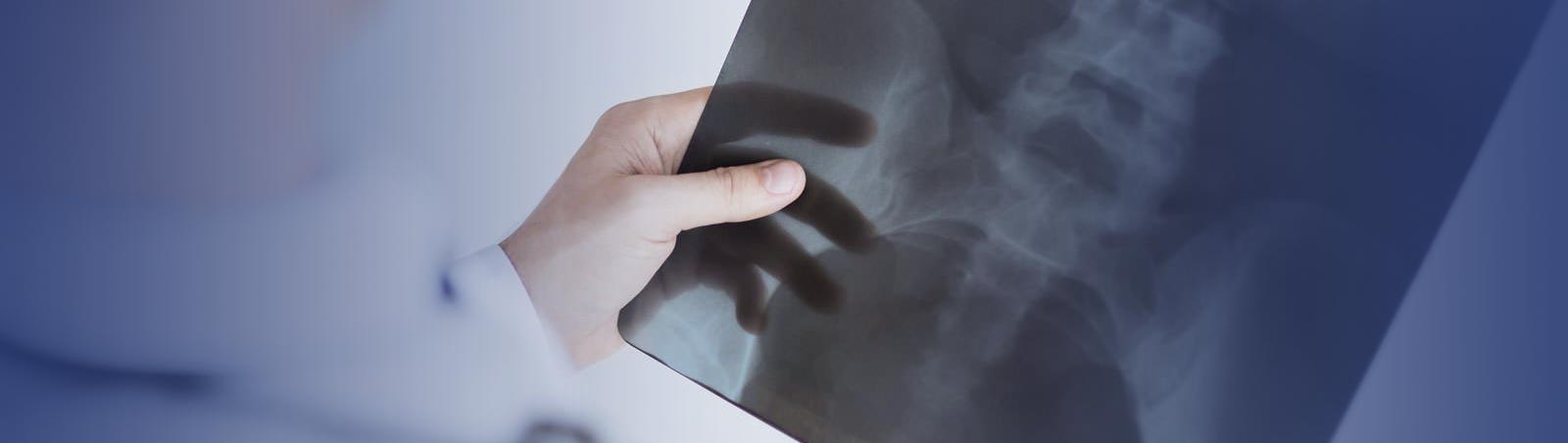 ΨΗΦΙΑΚΗ ΑΚΡΙΝΟΓΡΑΦΙΑ ΣΤΟ ΣΠΙΤΙ