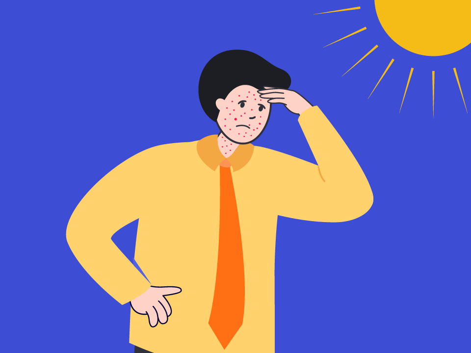 φωτοευαισθησια