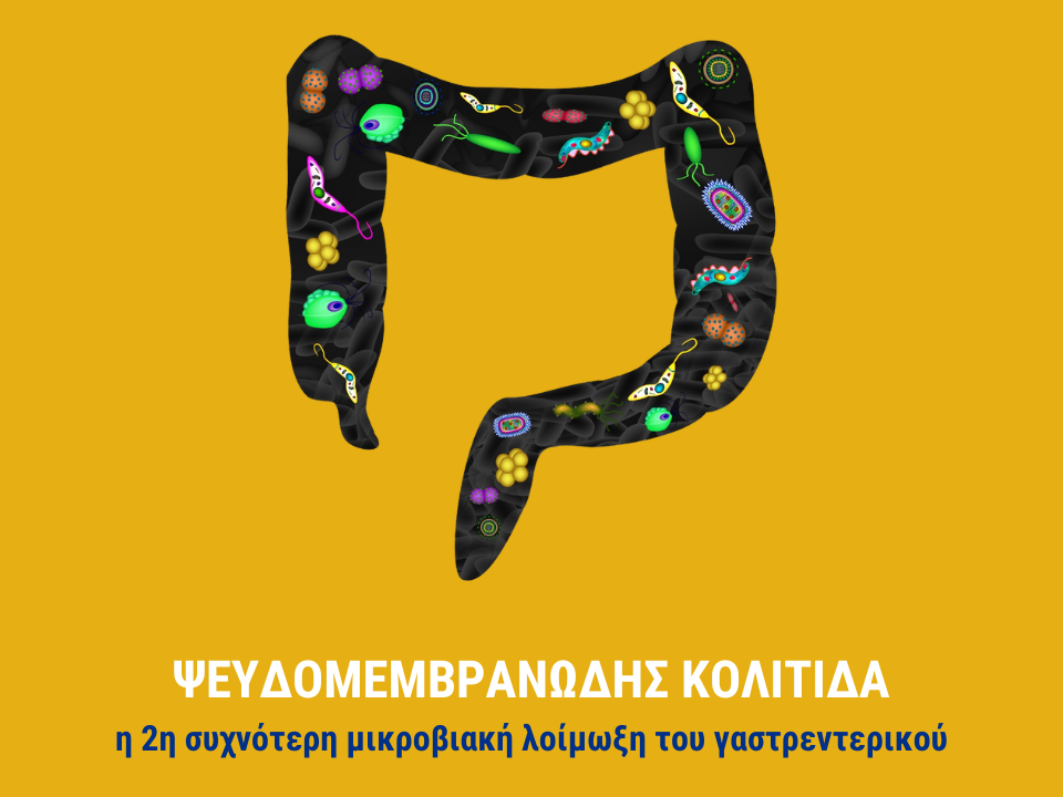 Ψευδομεμβρανώδης κολίτιδα